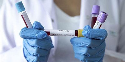 Koronavirüsle ilgili dünyayı sarsacak iddia!