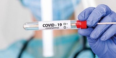 Kovid-19'un insanlardan hayvanlara bulaşma ihtimali...