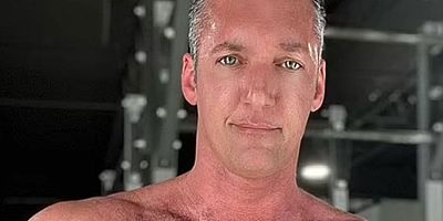 Maymun çiçeğine yakalanmıştı: Burnu çürüdü