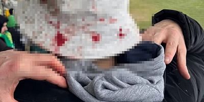 “Muş’ta Skandal! Bursaspor Taraftarına Taşlı Saldırı”