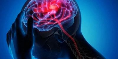 Nörologlar beyne en çok zarar veren gıdaları açıkladı!