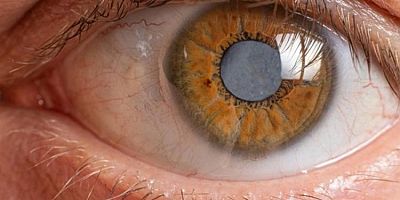 Sağlıklı gözler için günde bir avuç tüketin!