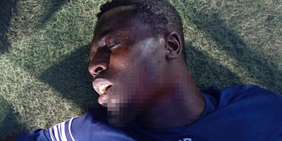 Sahaya girdiler, futbolcunun boğazını kestiler!