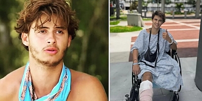Survivor'da bacağını kaybeden yarışmacıdan yeni paylaşım: Yeni hayatına alışmaya çalışıyor