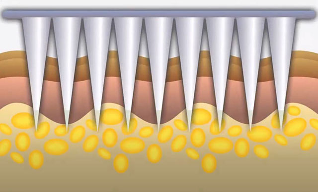 Uzun süre koruma vaat eden Kovid-19 aşı adayı, klinik deneyine başlıyor