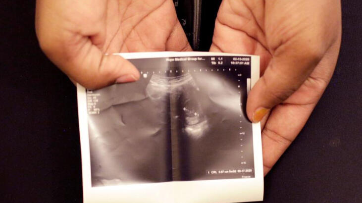 Tecavüzden hamile kaldı, kürtaj talebi reddedildi! AYM'den ders niteliğinde karar