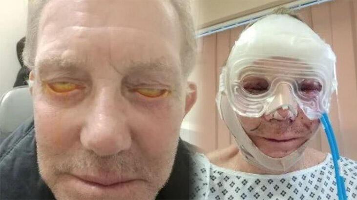 Üç yıldır gözlerini kapatamıyor! Çareyi Türkiye'ye gelmekte buldu...