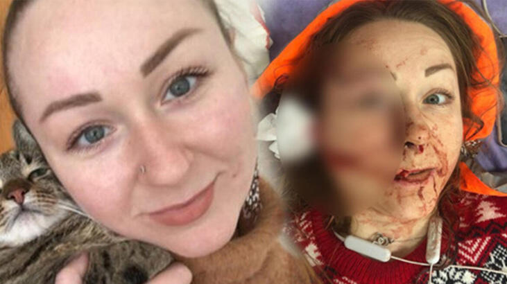 Ukraynalı eşe falçatalı dehşette korkunç gelişme! Sosyal medyadan duyurdu