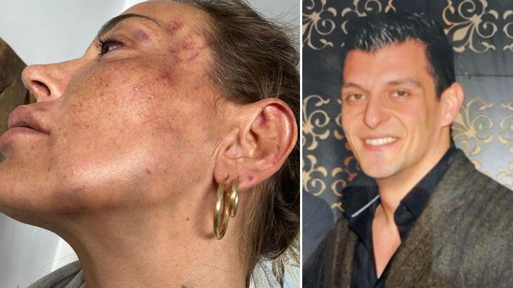 Uzaklaştırma kararı da durduramadı! Arabadan atlayıp kurtuldu